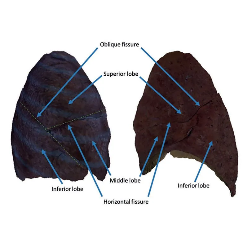 3D Printed Right Lung, Hilum Removed